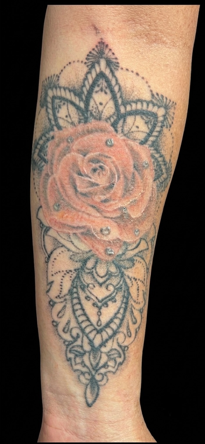 Reforma de tatuagem antes — Carlos Tattoo BH